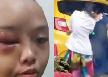 Viral! Gadis Yatim Piatu di Kampar Dianiaya Tante, Dibiarkan Lapar dan Tidur di Gudang